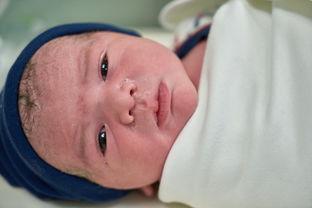 宝宝身高不达标需要打生长激素吗